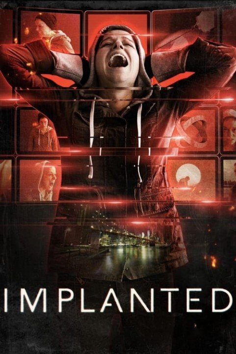 Implanted poster