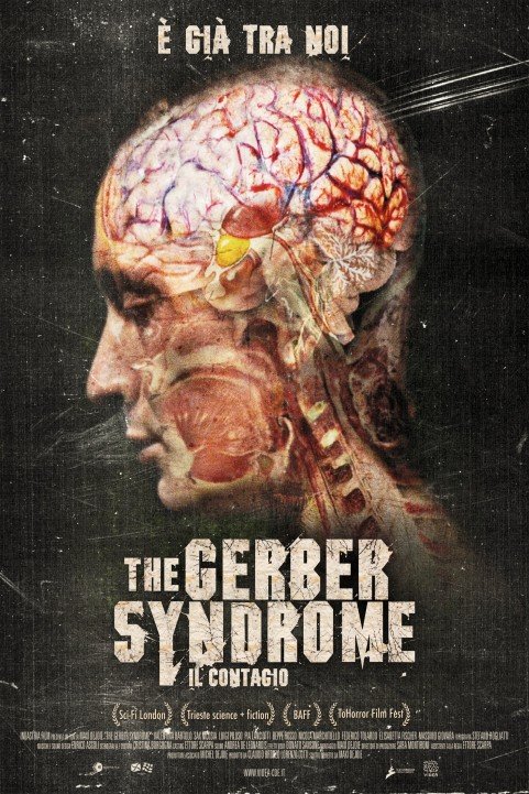 The Gerber Syndrome: Il Contagio poster