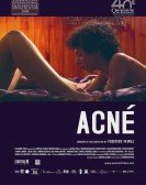 poster_acne_tt0815490.jpg Free Download