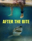 poster_after-the-bite_tt14746834.jpg Free Download