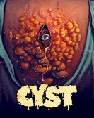 poster_cyst_tt10611992.jpg Free Download