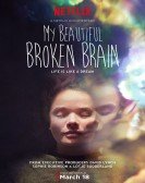 poster_my-beautiful-broken-brain_tt3815136.jpg Free Download