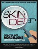 Skin Deep: The Battle Over Morgellons poster