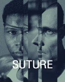 Suture Free Download