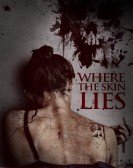 Where the Skin Lies Free Download